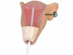 高級宮內(nèi)避孕訓(xùn)練模型